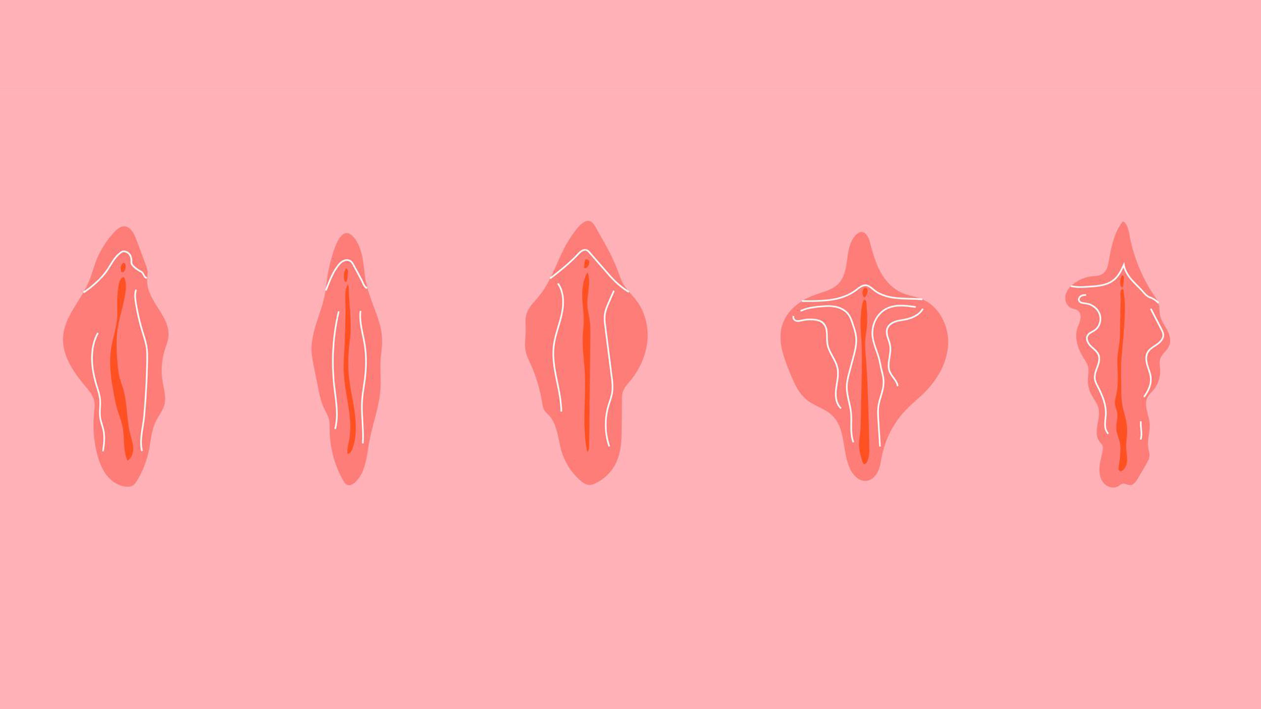 Lehrdiagramm mit verschiedenen normalen Variationen der Vulva-Anatomie