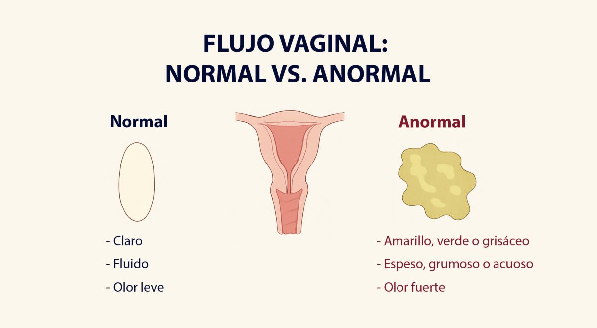 Imagen comparativa del flujo vaginal normal y anormal