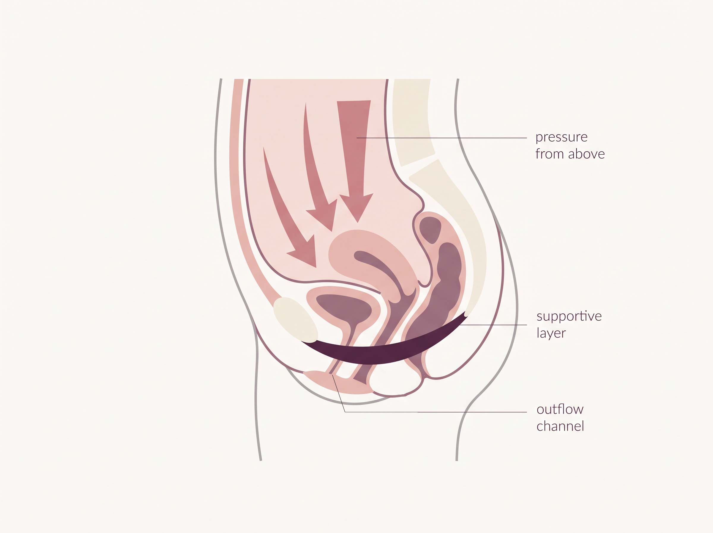 Editorial diagram showing downward abdominal pressure meeting the supportive layer beneath the urethra during a heavy lift