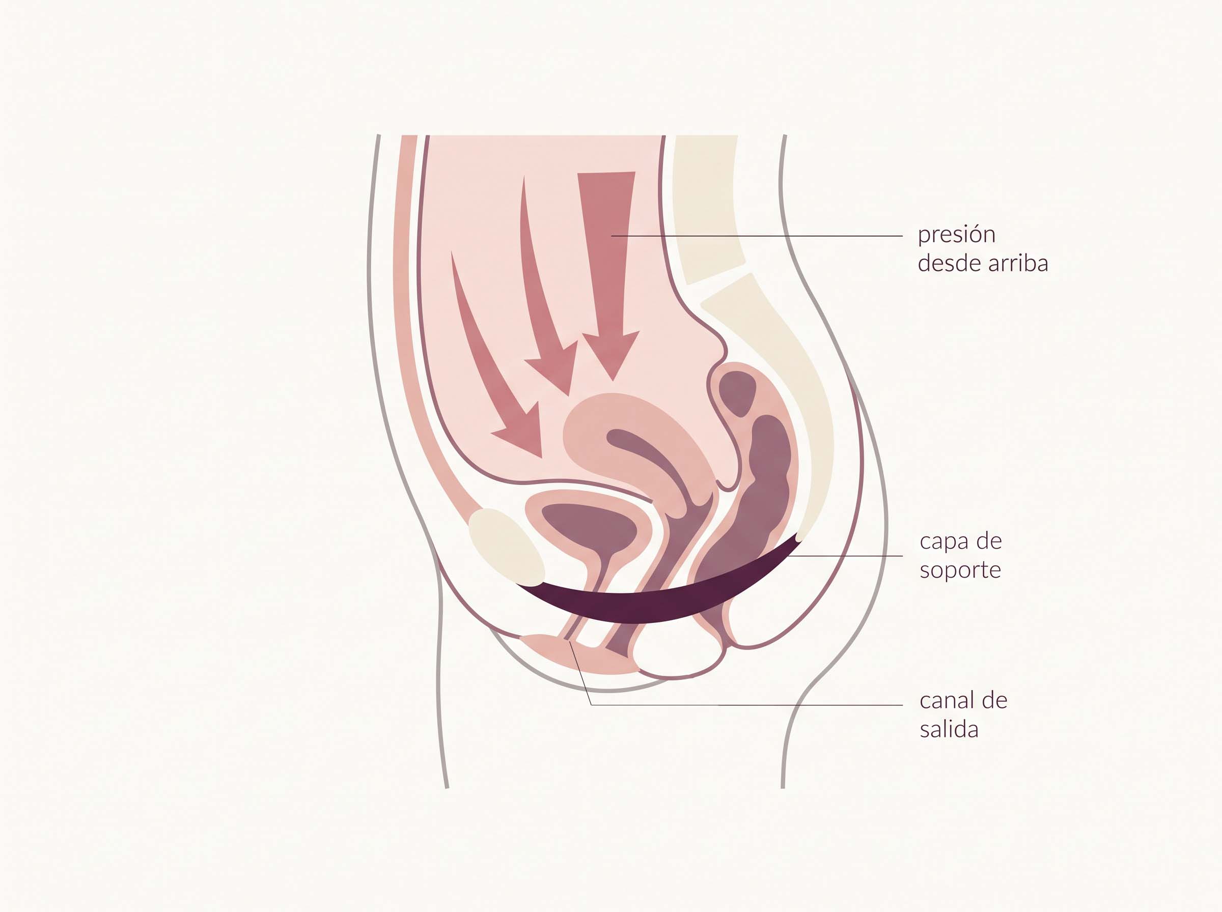 Diagrama editorial que muestra la presión intraabdominal descendente al encontrarse con la capa de soporte debajo de la uretra durante un levantamiento pesado