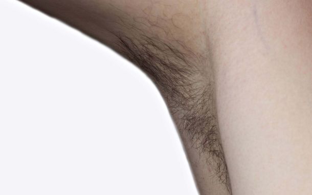 Women's Concerns Over Body Hair