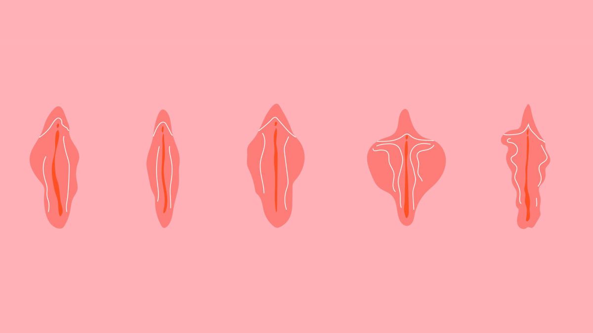 Diagrama educativo que muestra diferentes variaciones normales de la anatomía de la vulva