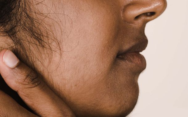 What is Hirsutism and What Causes It