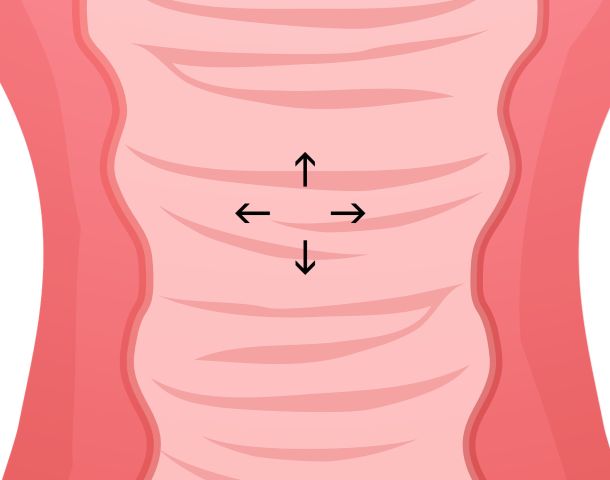 Cut away of the vaginal canal
