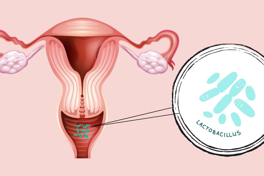 Illustration of the vaginal area showing a healthy pH balance and protective Lactobacilli bacteria.