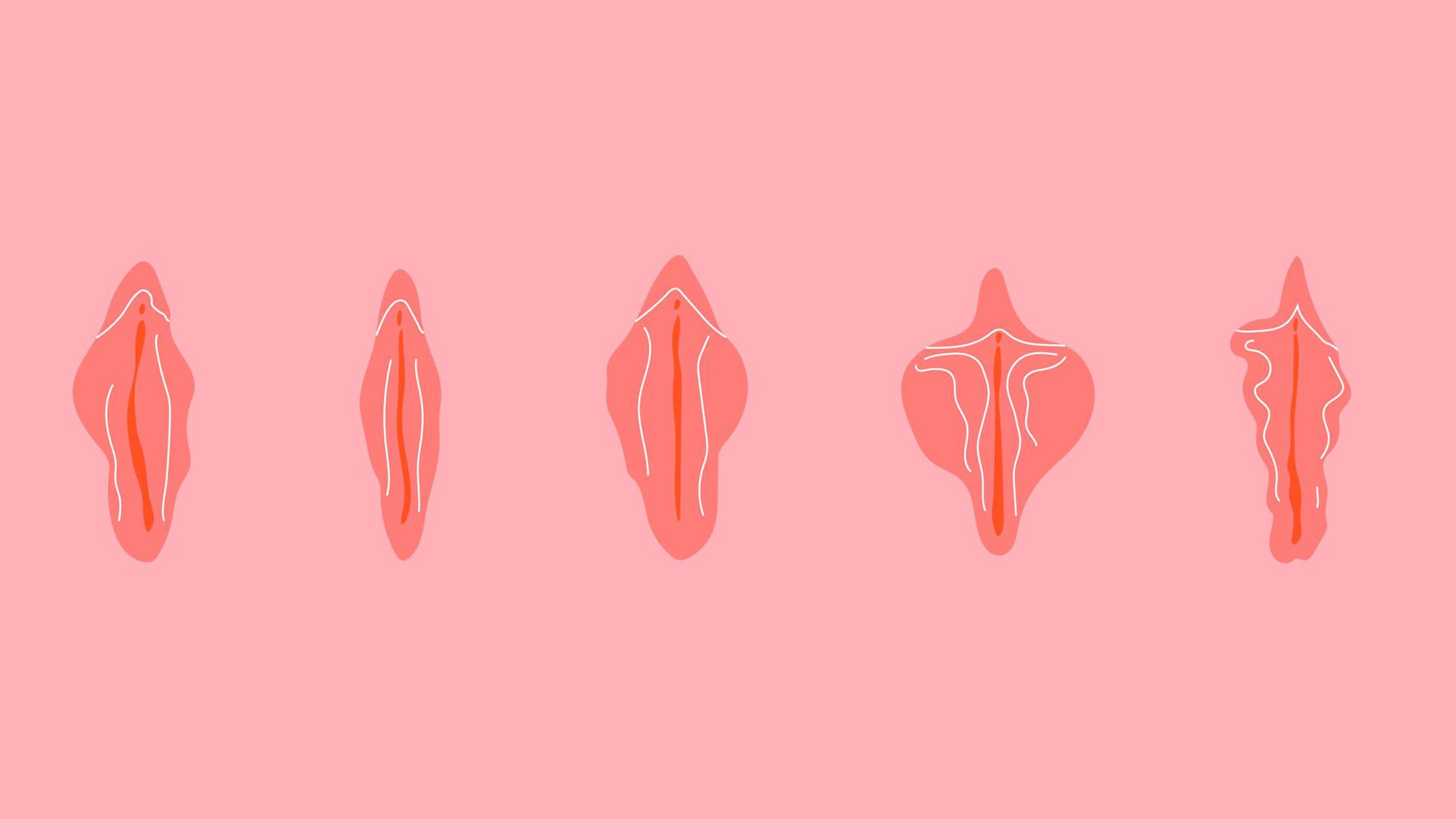 Diagrama educativo que muestra diferentes variaciones normales de la anatomía de la vulva